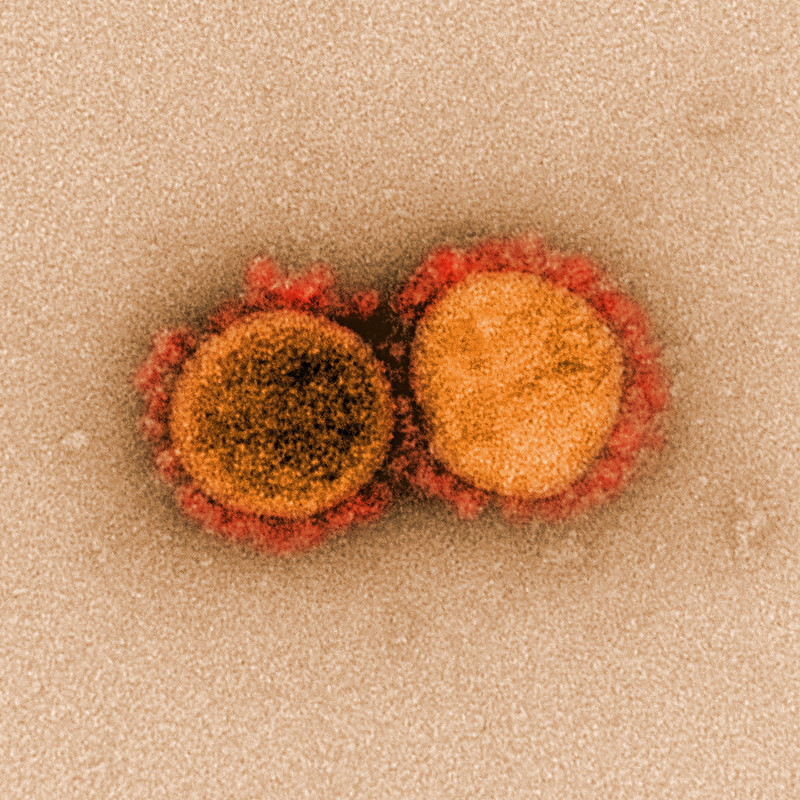 coronavirus_NIAID