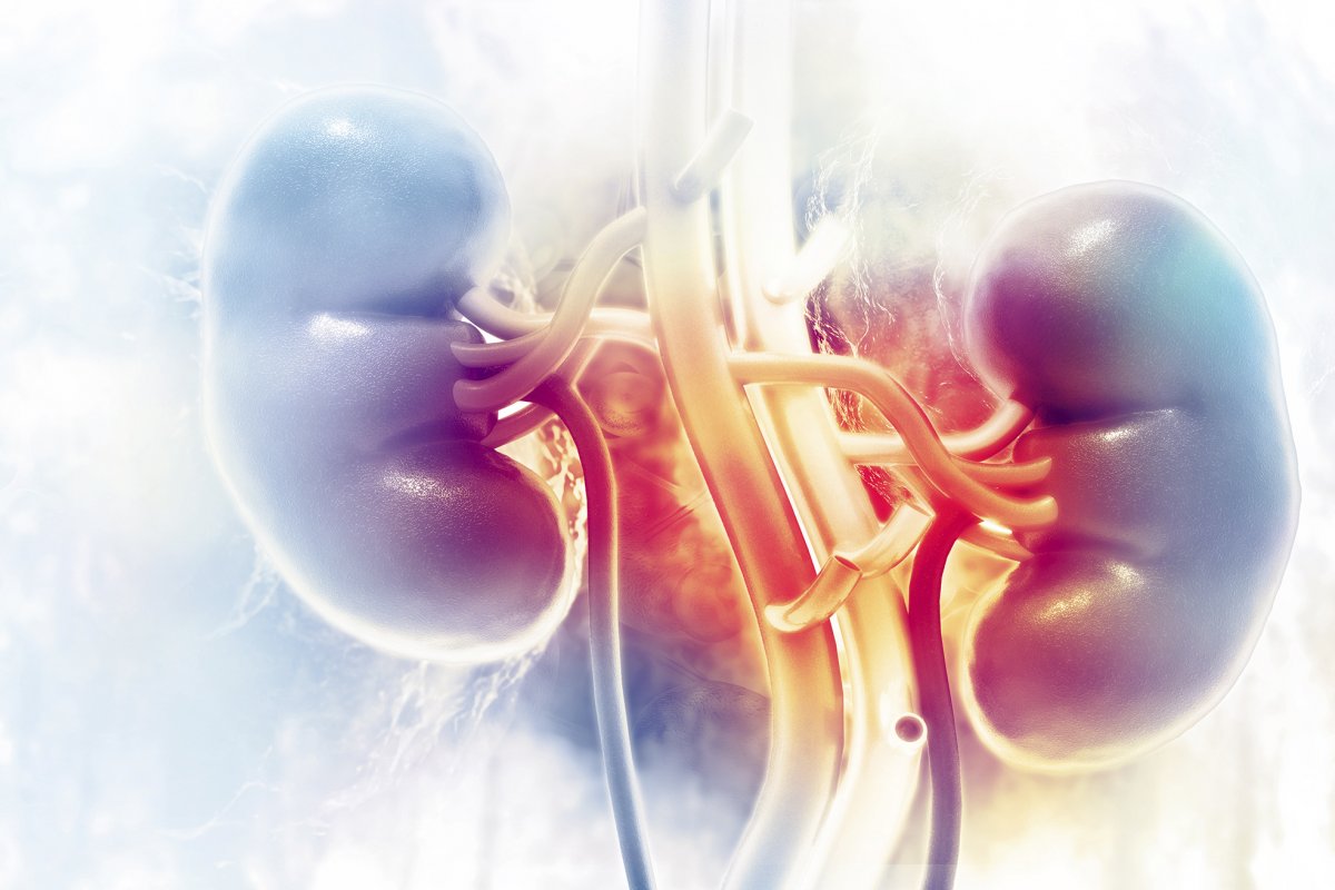Health |  Nephrolithiasis or kidney stones