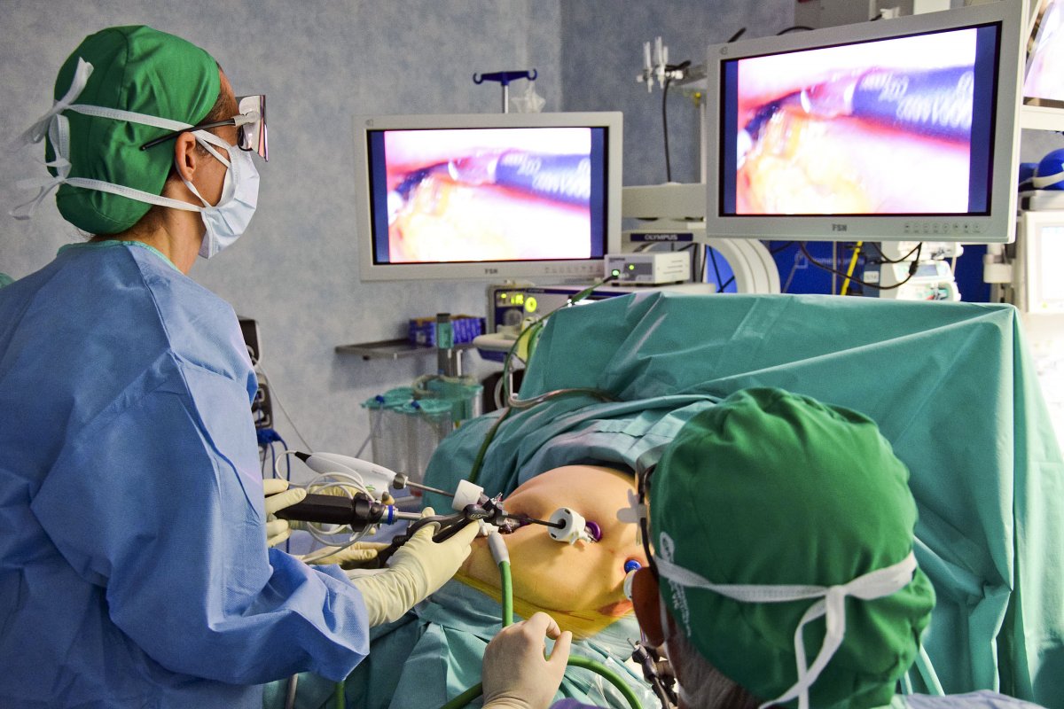 Una operació de cirurgia bariàtrica al Consorci Hospitalari de Vic