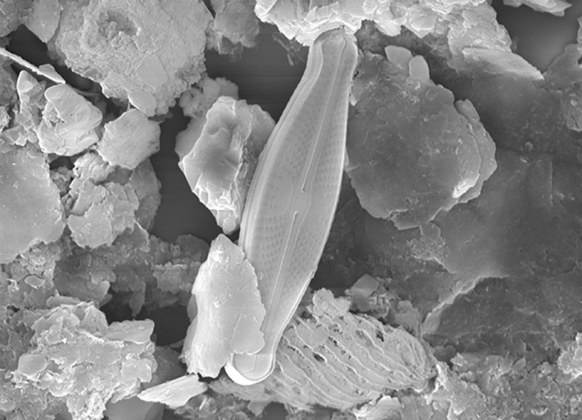 Imatge al microscopi de la diatomea
